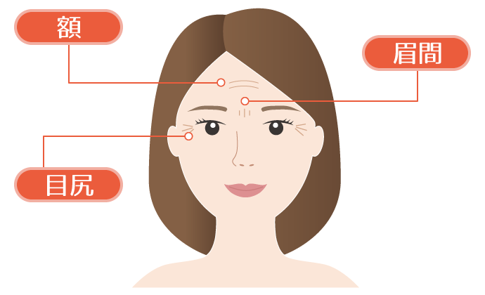ボトックス注射 各部位の範囲（眉間、目尻、額）